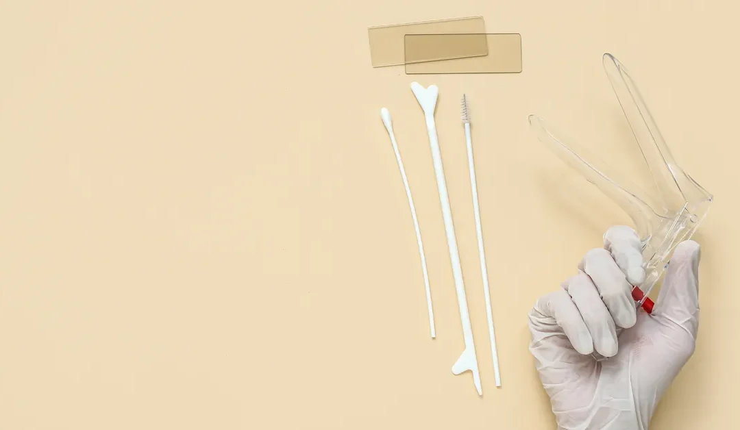 Smear test: what to expect & why it matters