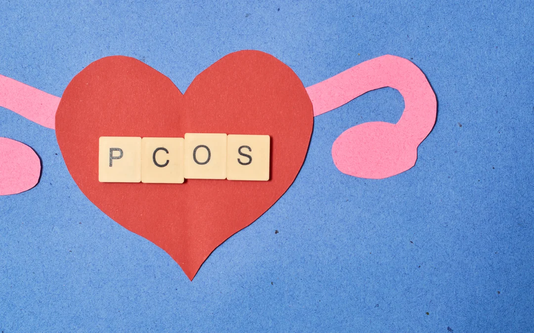 PCOS: More Than Just Irregular Periods